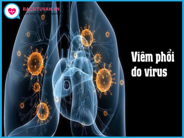 Nguyên nhân viêm phổi do virus