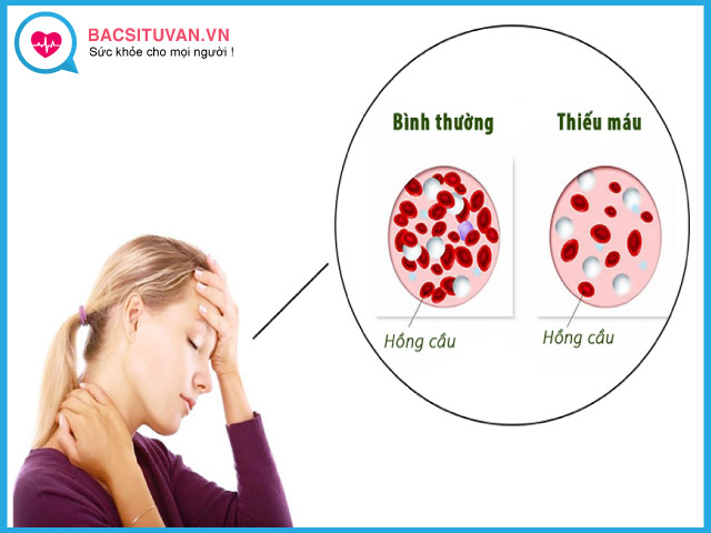 Biểu hiện lâm sàng của bệnh thiếu máu do beta thalassemia và thiếu máu kéo dài
