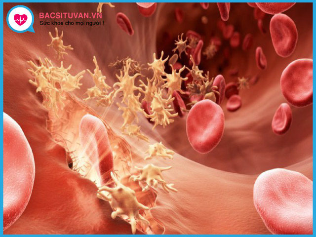 Bệnh thalassemia gây rối loạn đông cầm máu