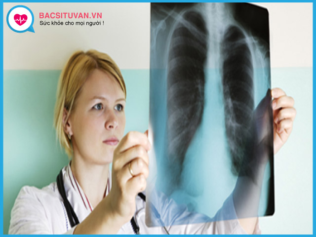 Chụp X-quang phổi để chẩn đoán bệnh bụi phổi amiăng
