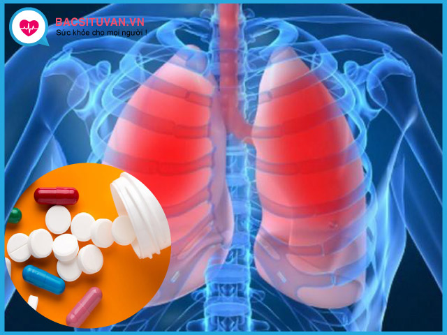 Điều trị viêm phổi do tụ cầu bằng kháng sinh