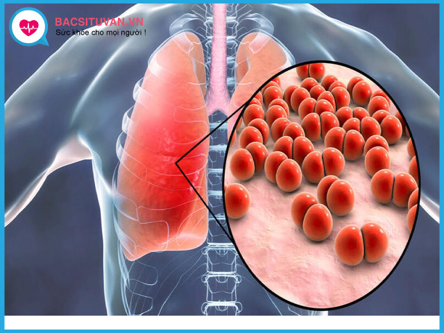 Một số yếu tố làm tăng nguy cơ mắc bệnh phổi kẽ