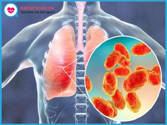Viêm phổi: Nguyên nhân, triệu chứng, chẩn đoán và điều trị