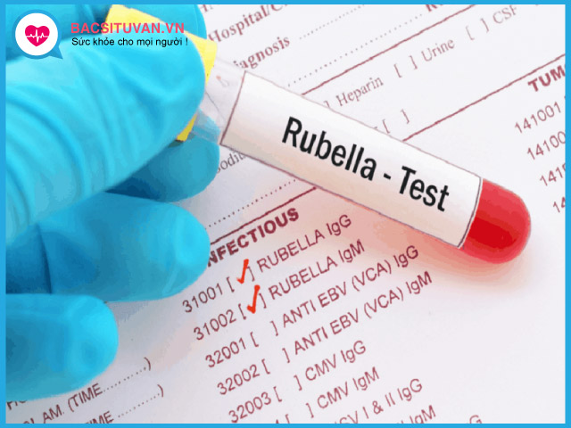 Chẩn đoán bệnh Rubella