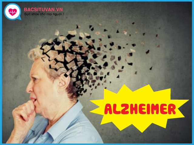 Bệnh Alzheimer là căn bệnh suy giảm trí nhớ, khả năng tư duy trầm trọng