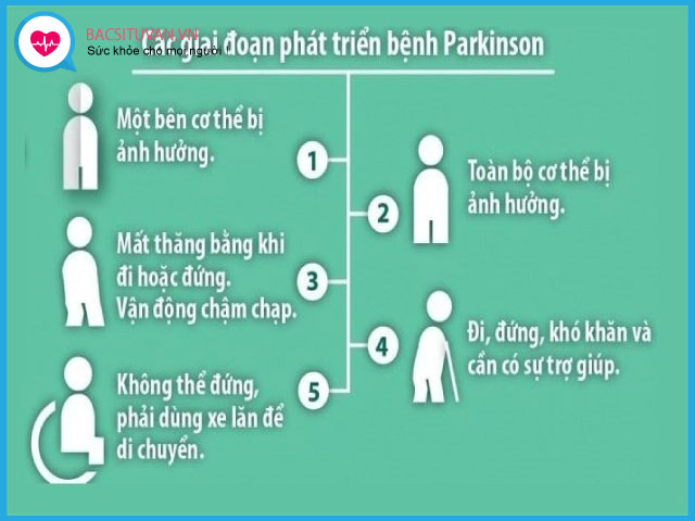 Các giai đoạn của hội chứng Parkinson 